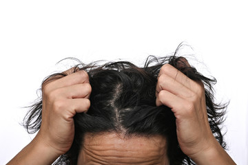 Man is checking hair, dandruff problems and face skin problems close up head on white background