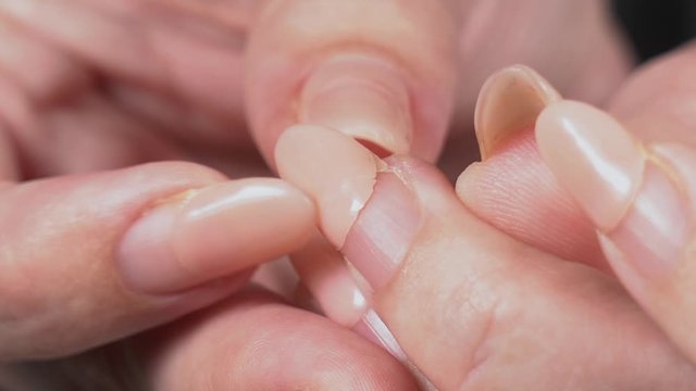 Closeup view video of broken nail of woman with old regrown worn manicure with abruption of gelpolish during period of staying home because of quarantine time.