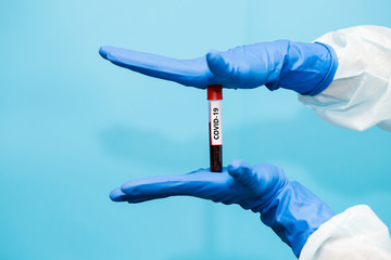 Doctor in blue glove holds test tube containing blood sample that has tested for coronavirus. Laboratory testing patients blood for presence of coronavirus COVID-19.