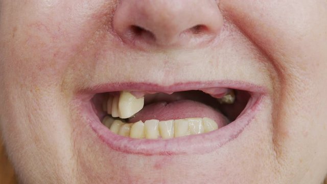 Close-up toothless mouth of an woman.