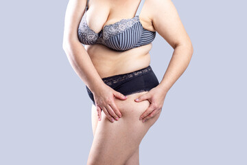 Real Body Plus Size Woman model in lingerie showing fat on leg