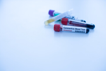 Obraz premium Corona-19 Virus Diagnostic Laboratory, select focus