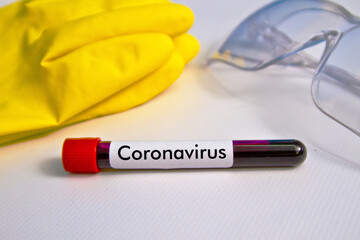 Blood sample on the background of rubber gloves and glasses on the table. The sample is on the...