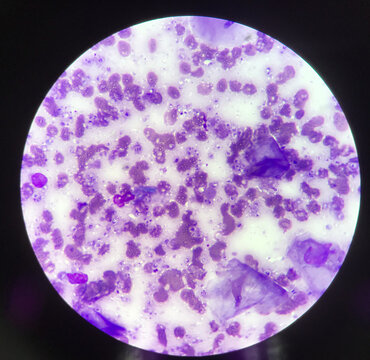 Budding yeast cells binary fission cells in smear.