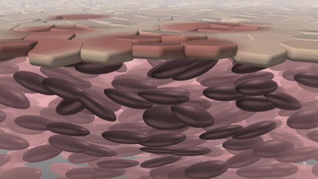 Skin damaged by UV rays or sunlight.