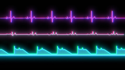 Neon line shows heartbeat isolated. Heart rates light sign on display screen medical research. Colorful Illustration