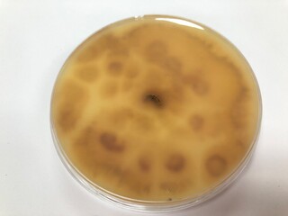 Fototapeta na wymiar Microsporum gypseum on Sabouraud dextrose agar at 25°C, 10 day