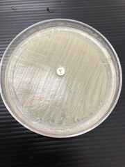 NOVOBIOCIN TEST : Staphylococcus saprophyticus on Mueller hinton agar