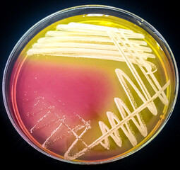 staphylococcus aureus growth on Mannitol salt agar 24h, incubate at 37 celcius