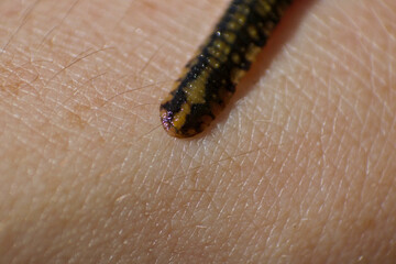 Leech on skin