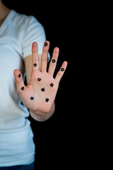 Concept photo of person with coronavirus COVID-19 on hand. Open hand held out in stop gesture