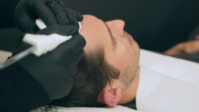 High quality close-up 4k slow motion video of a man laying on a couch during the esthetician hair treatment. Male tricopigmentation service. Scalp micropigmentation treatment. Trichopigmentation 