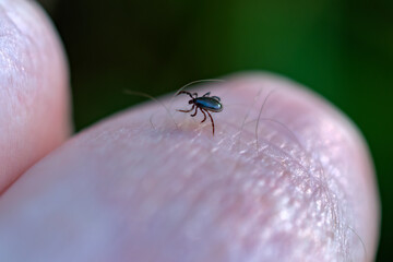 Small tick on human finger, danger in forest.