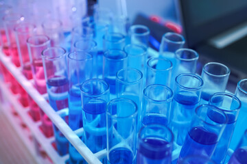 lab supplies glass test tubes, blood test tubes and microscope