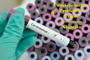 Obraz premium Coronavirus, pandemia, virus, acabar, tregua, 