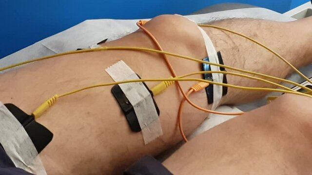 Electrostimulation of the quadriceps as a physiotherapy therapy
, 4K video