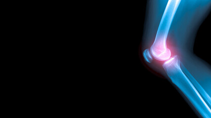 x-ray image OA with banner space