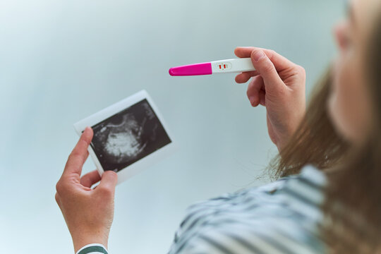 Woman holds a positive pregnancy test and ultrasound picture. Planned and long-awaited pregnancy