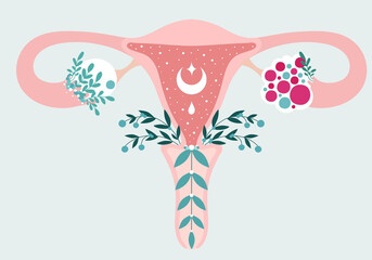 Women health - Floral Infographic of Polycystic ovary syndrome. Patient-friendly scheme of PCOS, Multifollicular cyst. Gynecological problems - Neutral medical diagram uterus and uterine appendages