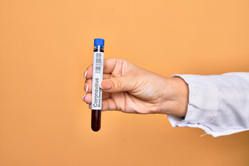 Obraz premium Hand of caucasian young woman holding tests tube with coronavirus results over isolated yellow background