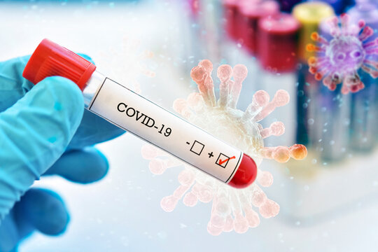 Covid-19, coronavirus, virus, infecci&oacute;n, espa&ntilde;a, italia, china, el mundo, mundial, pandemia