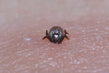 Super close up of sucking Ixodes ricinus on human skin. Adults feed on large mammals such as sheep, cattle, dogs, deer, humans, and horses for 6–13 days, before dropping off.