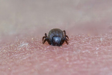 Super close up of sucking Ixodes ricinus on human skin. Adults feed on large mammals such as sheep, cattle, dogs, deer, humans, and horses for 6–13 days, before dropping off.