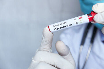Obraz premium laboratory technician hand holding blood test tube 