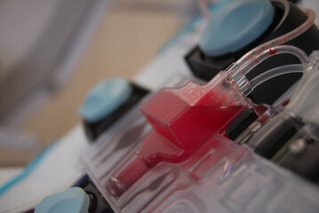Blood in a transparent blood separator of blood platelet donation machine