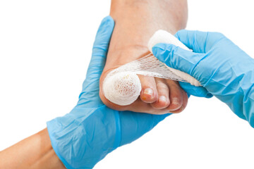 Bandaged injured toenail