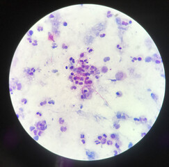 Red branching mycobacterium tuberculosis on blue background in modified acid fast bacilli stain.