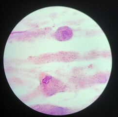 strongyloides stercoralis parasit in human.