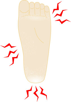 417 Best 水虫 Images Stock Photos Vectors Adobe Stock