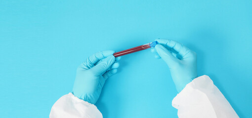 Hand with glove and PPE suite is holding blood tube on white background.
