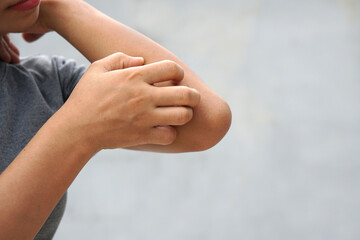 Woman scratching arm from itching on light gray background. Cause of itchy skin include insect bites, dermatitis, food/drugs allergies or dry skin. Concept of health care skin.