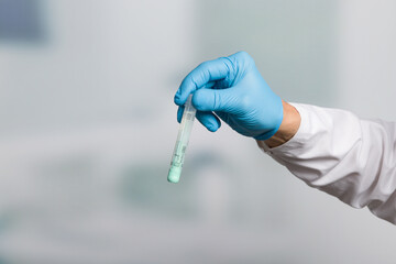 doctor's hand in medical gloves holds a tube for stool sample for colon cancer screening