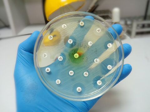 Scientist hold a Culture plate of bacterial growth showing antibiotic sensitivity in their colony. Drug sensitivity test, disk drug, antibiotic sensitivity, close up view. Escherichia coli.
