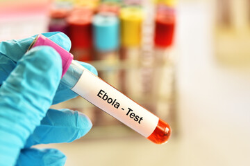 Test tube with blood sample for ebola virus test