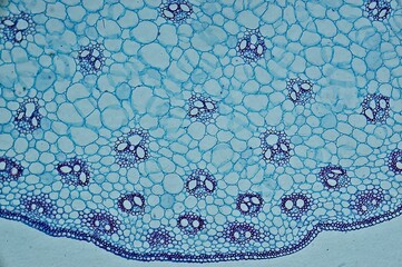 Corn ster c.s. under microscope © Daniel