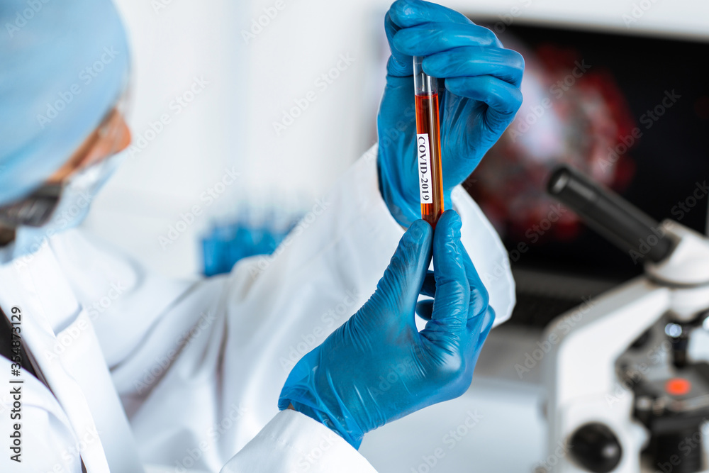 Wall mural tube with the tested test in the hands of a laboratory assistant .