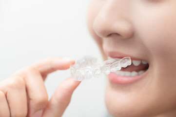 Woman wearing orthodontic silicone trainer. Mobile orthodontic appliance for dental correction. tooth whitening systems.