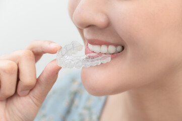 Woman wearing orthodontic silicone trainer. Mobile orthodontic appliance for dental correction. tooth whitening systems.