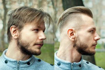 bald man before after haircut Concept for a barber shop: the problem man of hair loss, alopecia,...