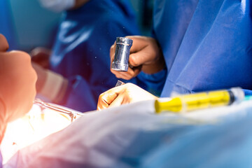 Professional doctors in medical uniform making an operation. Process of operation by neurosurgeons. Close-up.