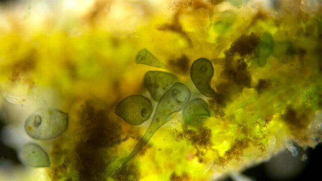 colony Infusoria Stentor under the microscope, the family Stentoridae, class Ciliata, feed on small organic residues, bacteria, algae, protozoa. Also on the video a lot of rotifers Philodina