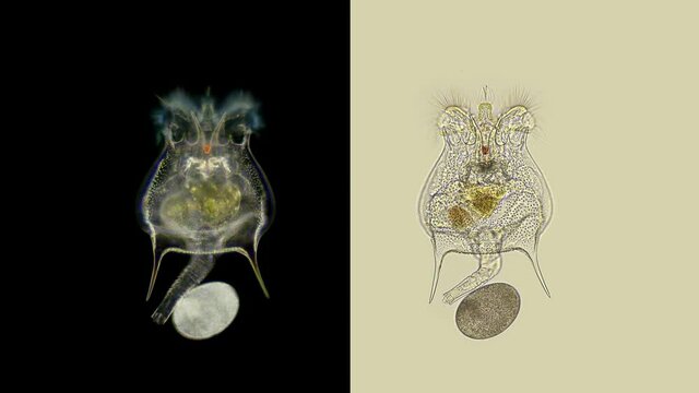 Rotifers Brachionus sp. under a microscope, of the family Brachionidae, order Ploima, planktonic, lives in fresh and brackish water, withstands drought, in the video, a female with an egg