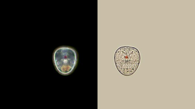 Keratella rotifer eggs under a mycoscope, an already formed embryo with a large red eye is visible, later it will break the membrane and a young rotifer will appear