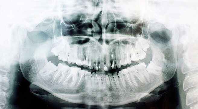 Image of doctor or dentist presenting with tooth x-ray film recommend patient in the treatment of dental and dentistry, working at workplace.