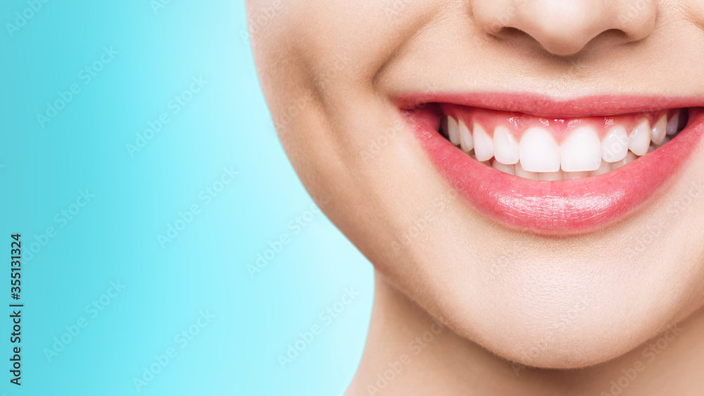 Wall mural closeup of smile with white healthy teeth.