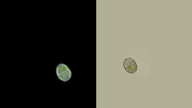 Infusoria Coleps under the microscope, family Colepidae, class Prostomatea, feeds on bacteria, algae, living and dead ciliates, are scavengers of the micro world